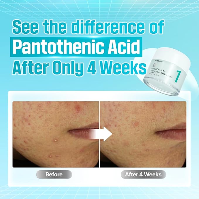 numbuzin No.1 Pantothenic B5 Active Soothing Cream | Lightweight Hydrating Moisturizer, Pantothenic Acid, Niacinamide, Panthenol | Excess Oil Control, Soothes Acne | Non-Comedogenic | 2.70 fl. oz.